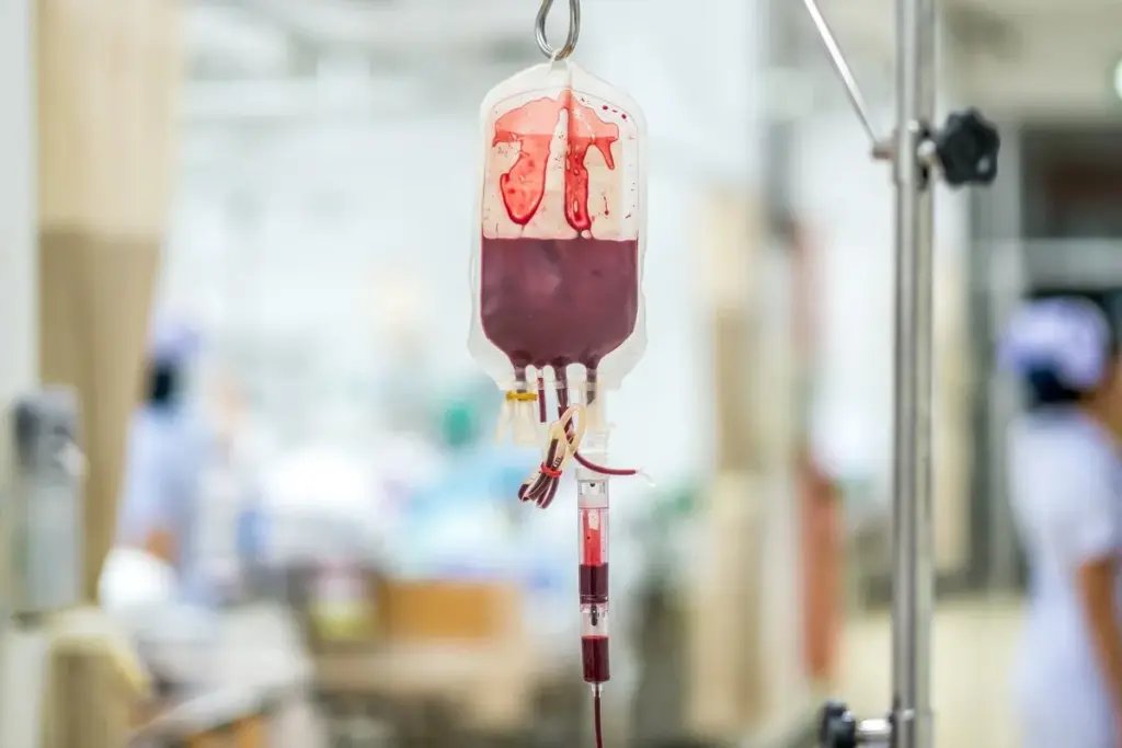 Platelet Transfusion: Dangerous Risks To Know