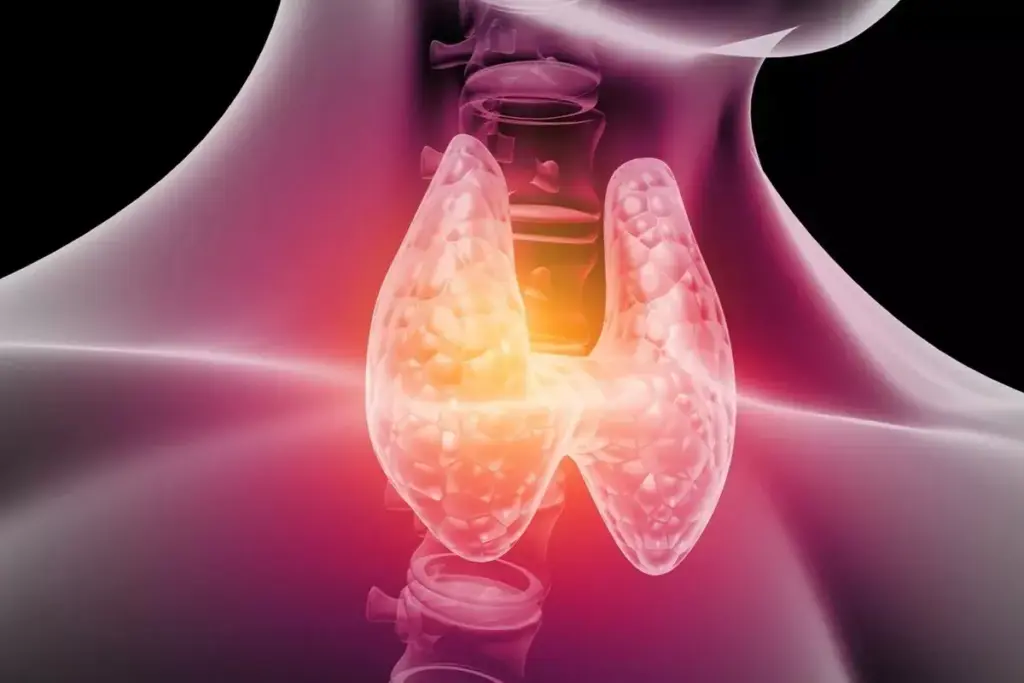 How to Fix Thyroid Problems Naturally: Supplements to Avoid