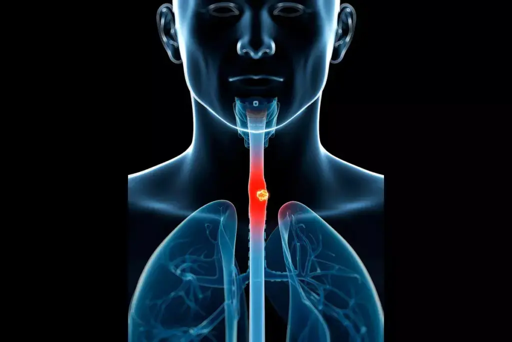 7 Key Differences Between Hypothyroid vs Hyperthyroid Symptoms 2 7 Key Differences Between Hypothyroid vs Hyperthyroid Symptoms
