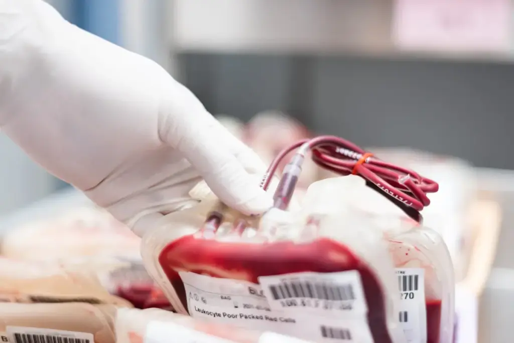 Allogeneic Blood Transfusion: Vital Facts Told