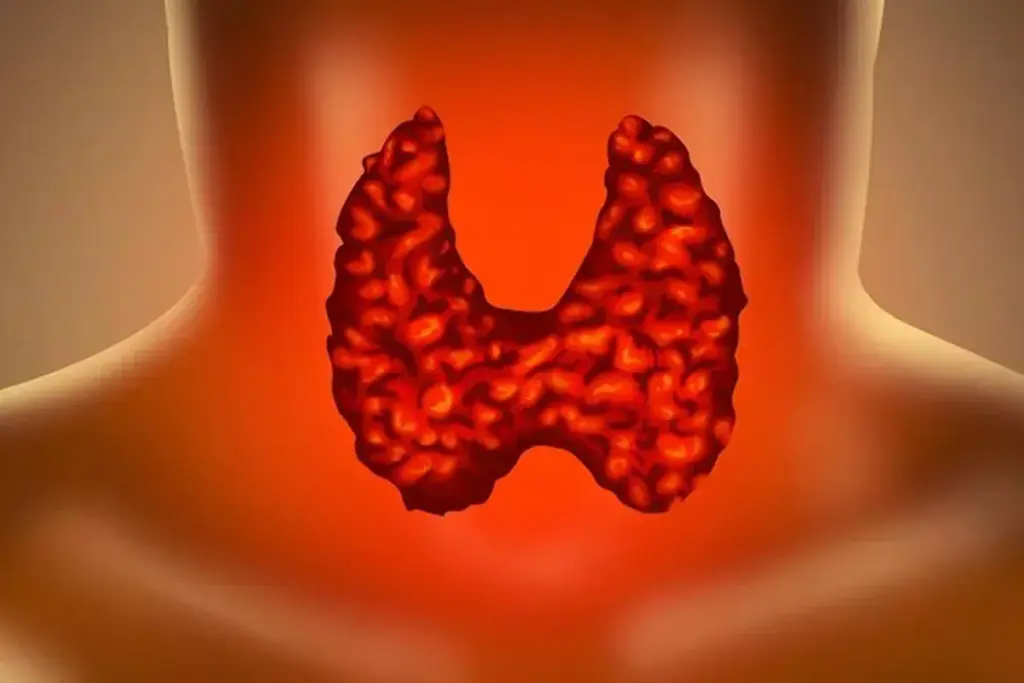 Can Hypothyroidism Cause Stomach Problems and Bloating?