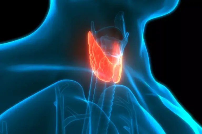7 Types of Hyperthyroidism: Pathology, Diagnosis & Management