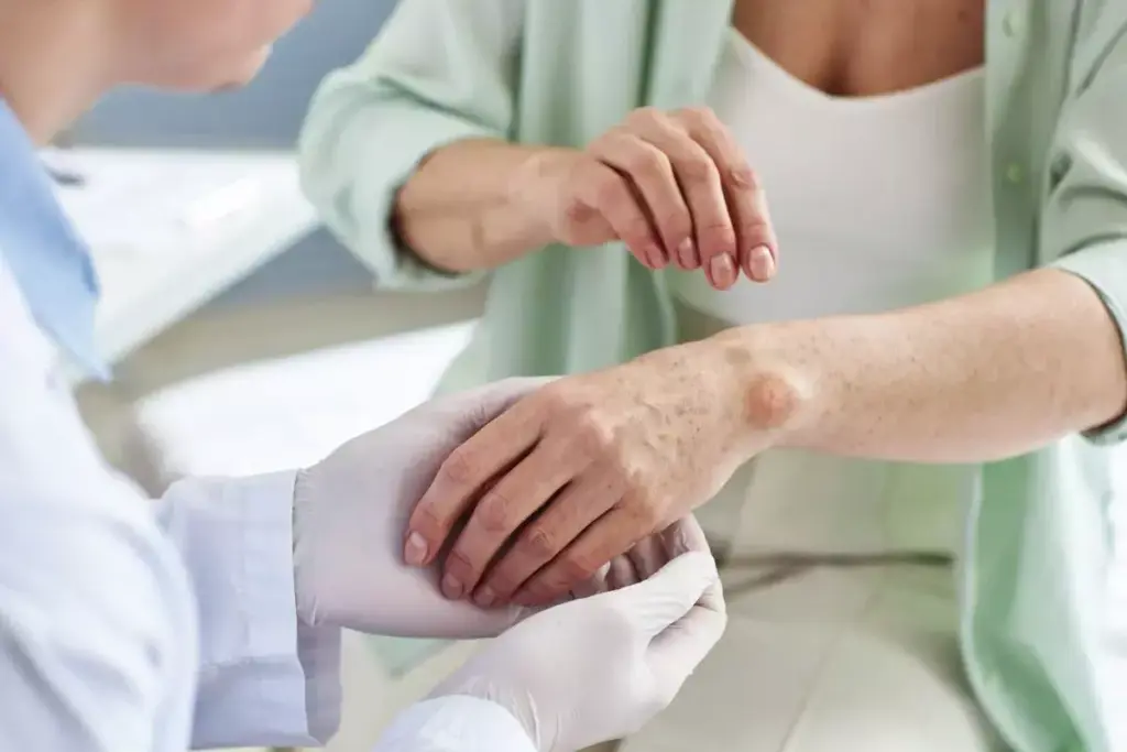 What Is Autoimmunity? Understanding Autoimmune Diseases Explained