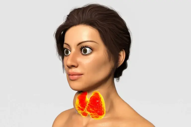 Can Graves Disease Go Into Remission or Be Cured?