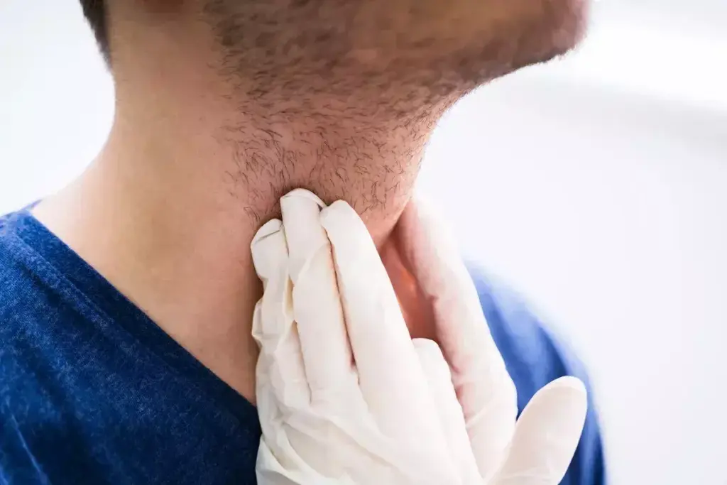 7 Essential Facts About Thyrotoxicosis With Diffuse Goiter