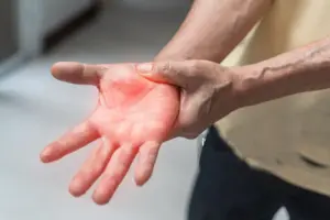 How to Diagnose Guillain-Barré Syndrome: Tests & Criteria