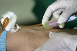 What Does High Thyroglobulin Antibodies With Normal TSH Mean?