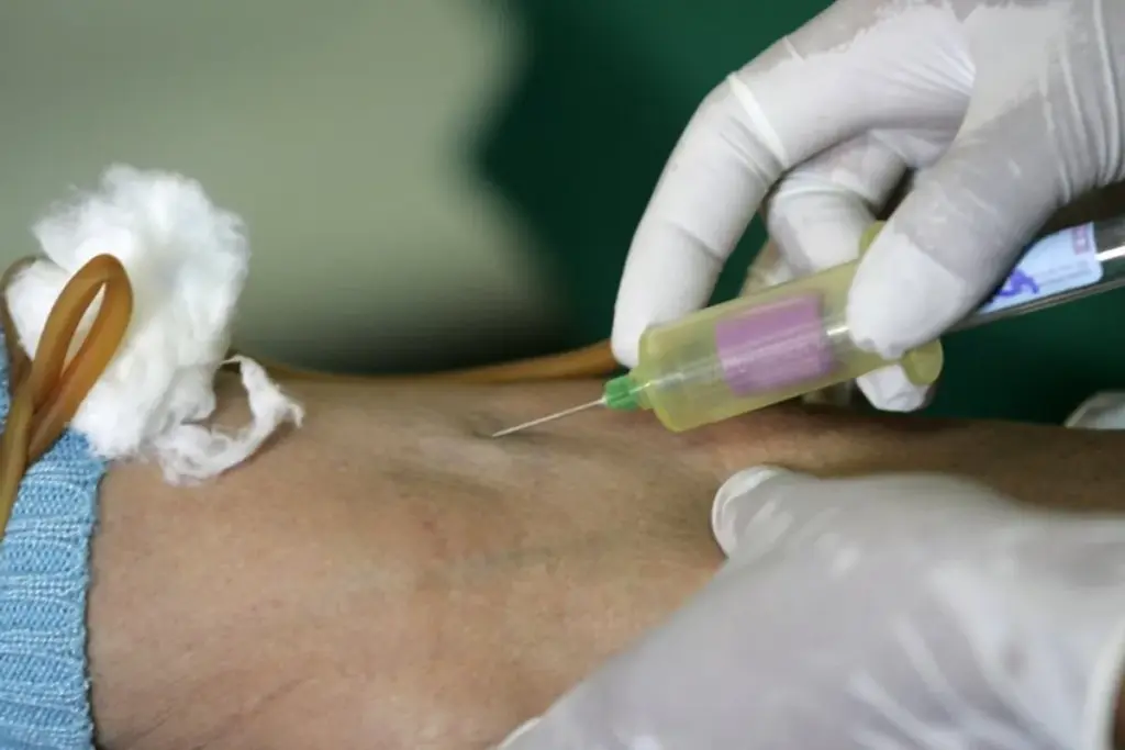 What Does High Thyroglobulin Antibodies With Normal TSH Mean? 1 What Does High Thyroglobulin Antibodies With Normal TSH Mean?