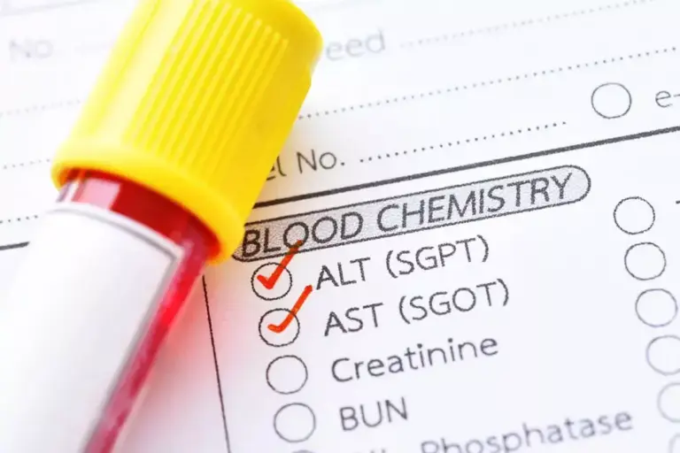 What Does High SGPT ALT Mean in Your Blood Test?
