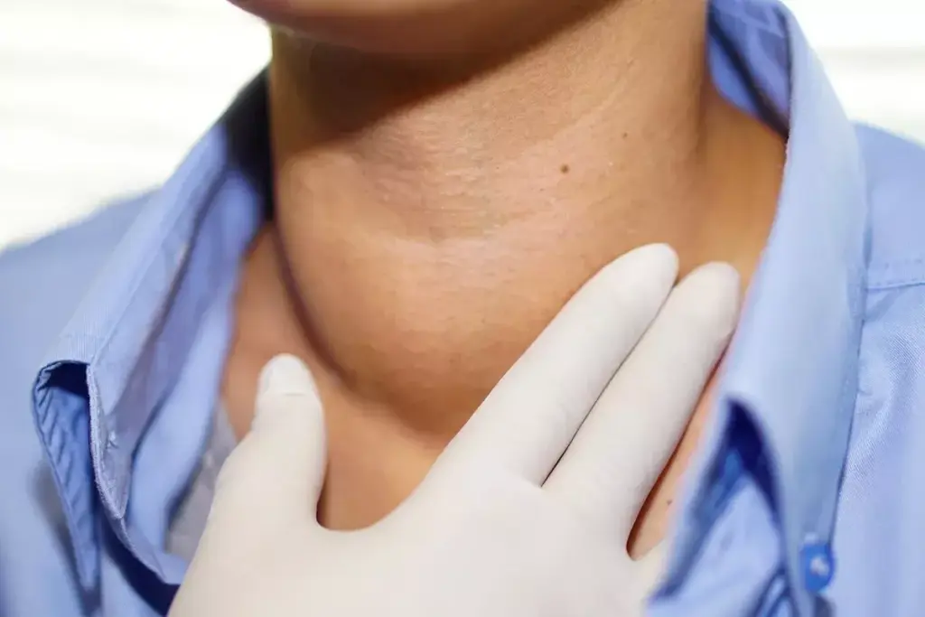 15 Rare Thyroid Diseases: Genetic Disorders Explained