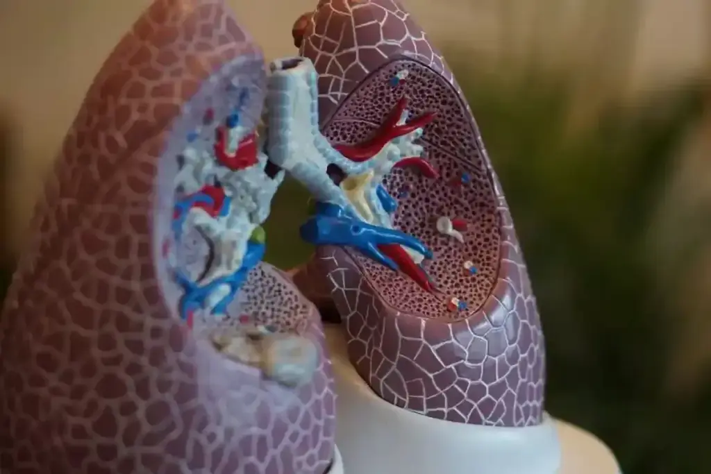 What Is GPA (Granulomatosis with Polyangiitis)?