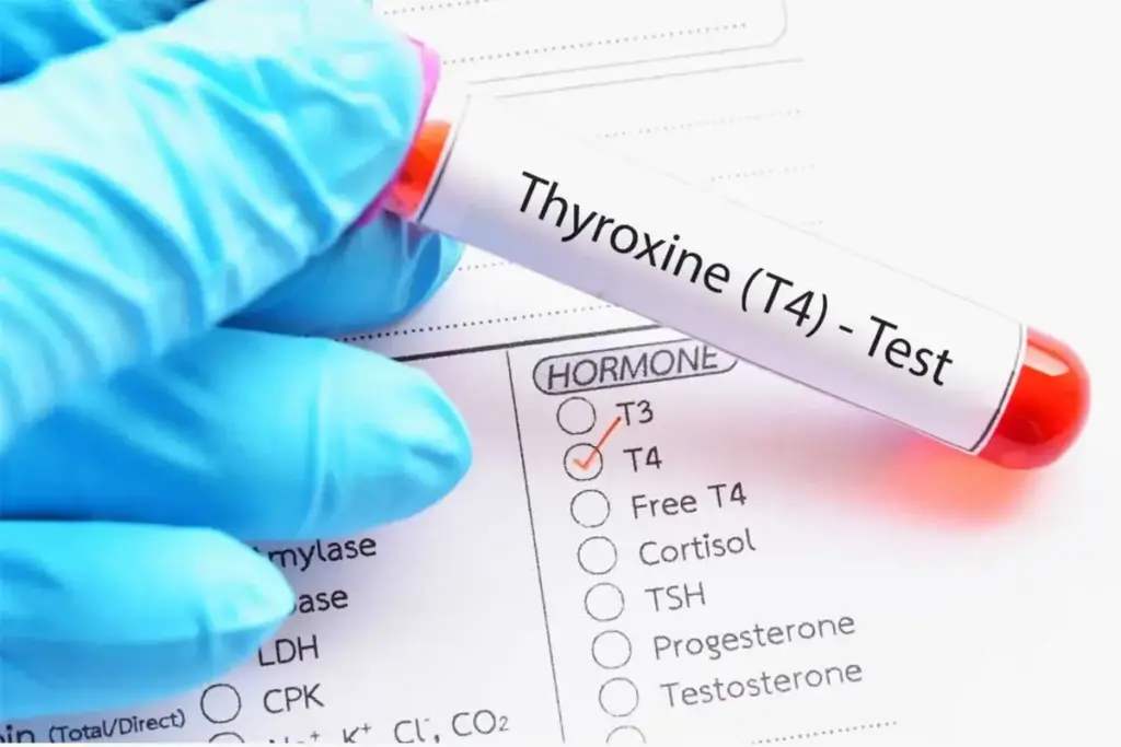 What Is Free T4 in Blood Work and Why Does It Matter? 1 What Is Free T4 in Blood Work and Why Does It Matter?