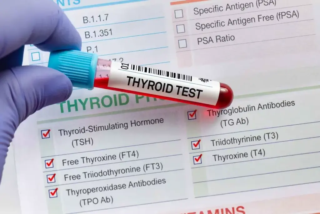 Thyroid Antibody Tests: 5 Key Labs for Hashimoto's and Graves Disease