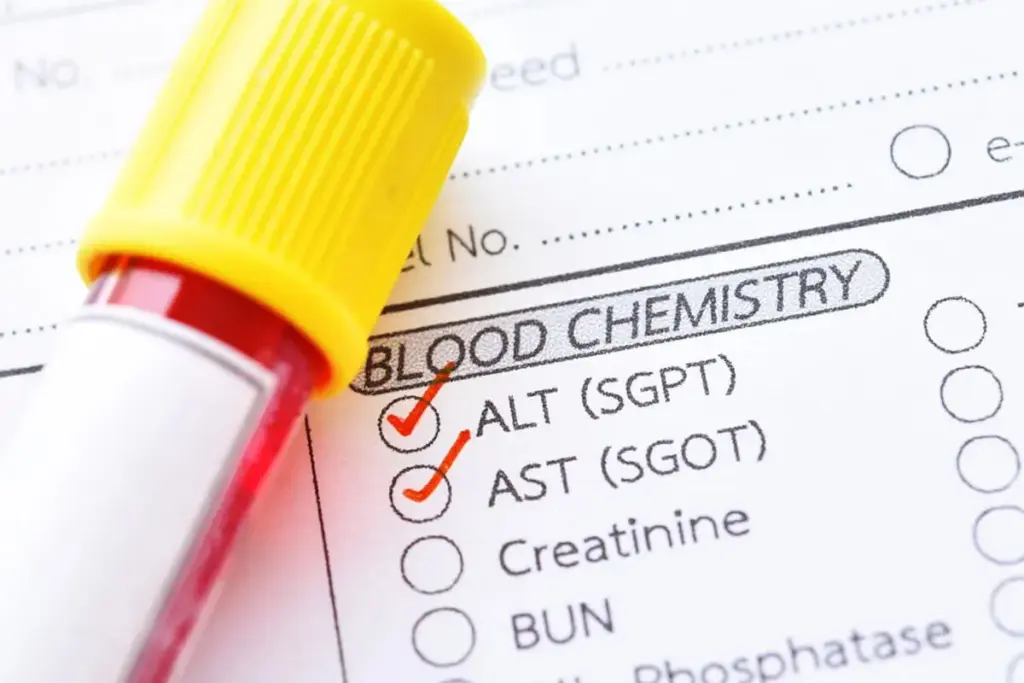 What Does High SGPT ALT Mean in Your Blood Test?
