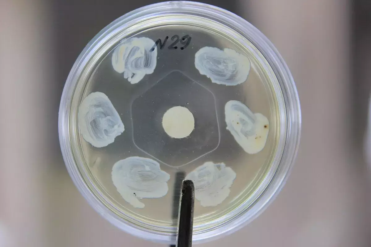 5 Key Features of Corynebacterium Diphtheriae Bacteria