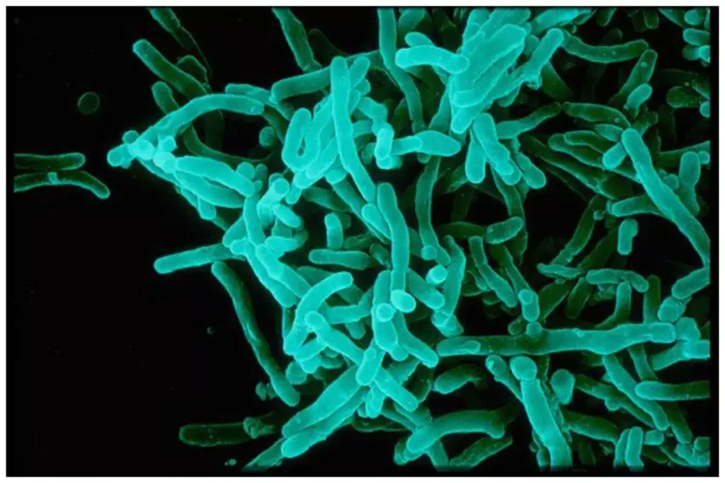 How to Prevent Pharyngeal Diphtheria: Essential Precautions