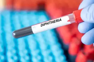 What Is the Diphtheria Incubation Period and How Does It Spread?