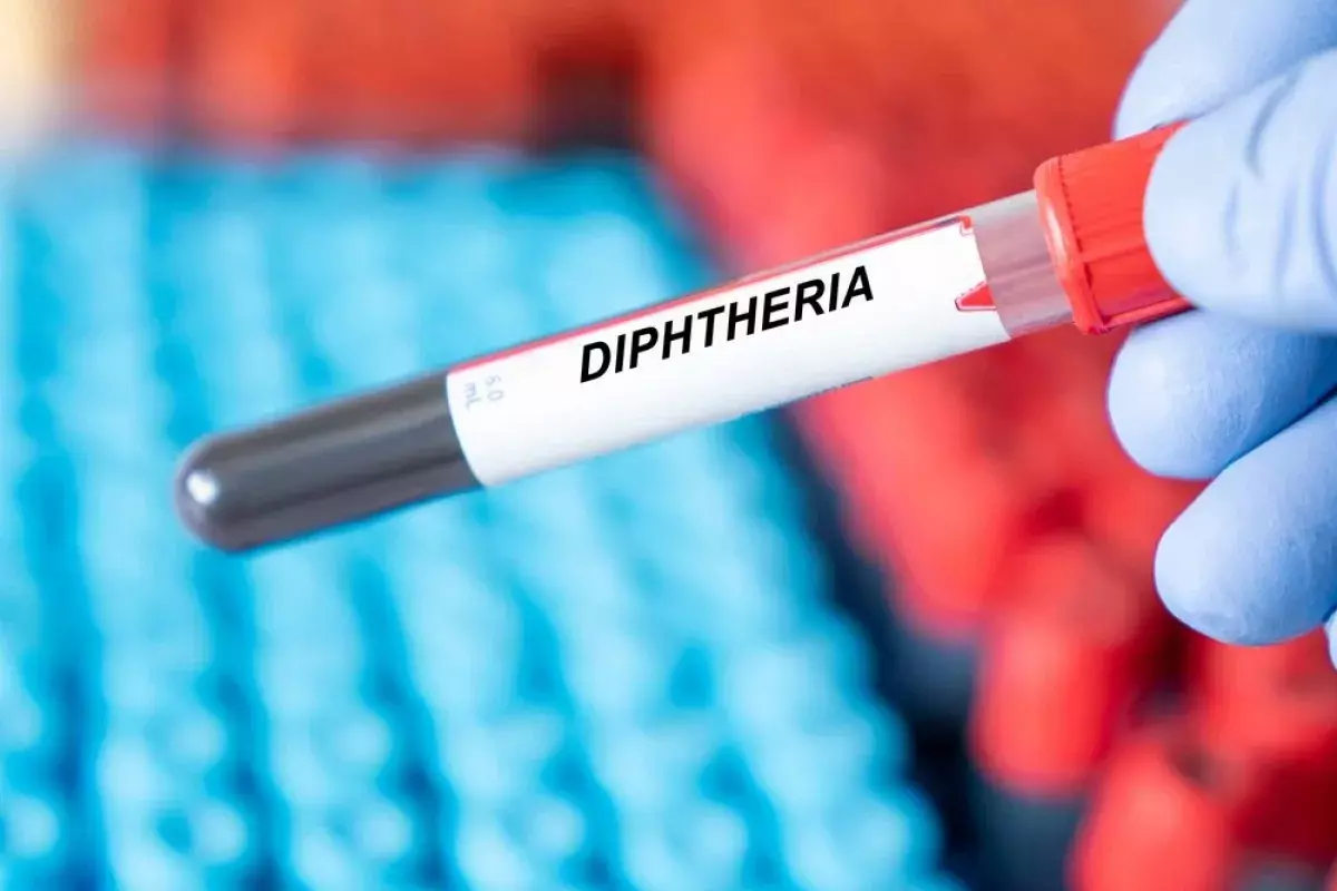 What Is the Diphtheria Incubation Period and How Does It Spread?