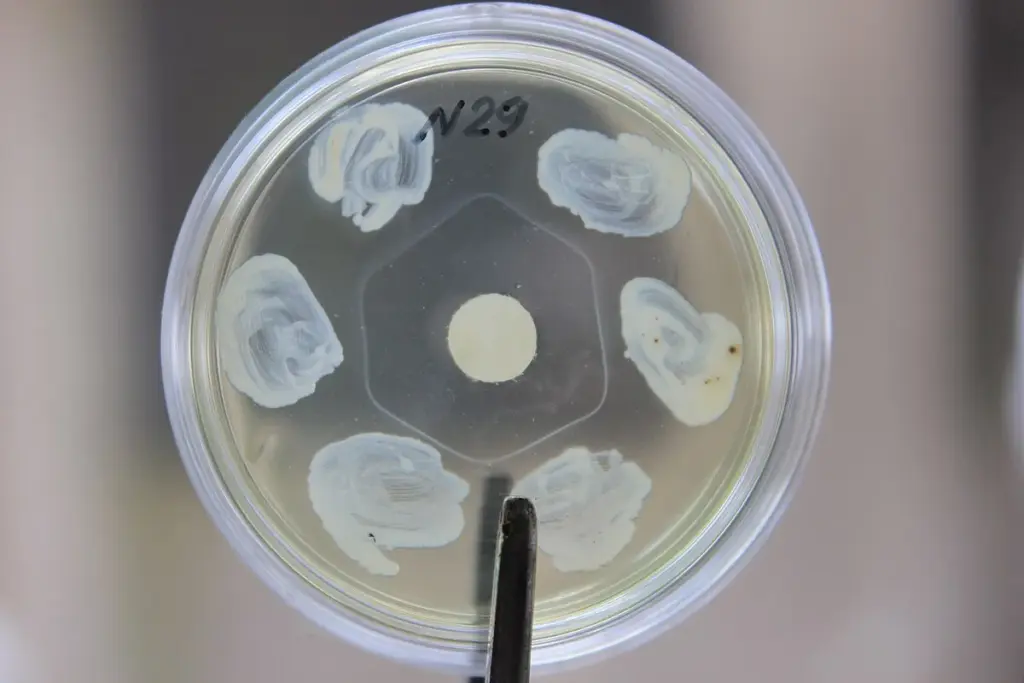 5 Key Features of Corynebacterium Diphtheriae Bacteria 1 5 Key Features of Corynebacterium Diphtheriae Bacteria