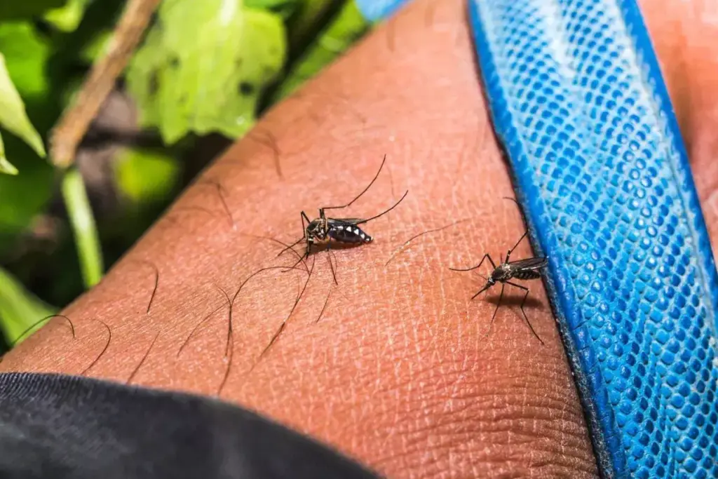How to Treat Aedes Mosquito Bites on Ankles