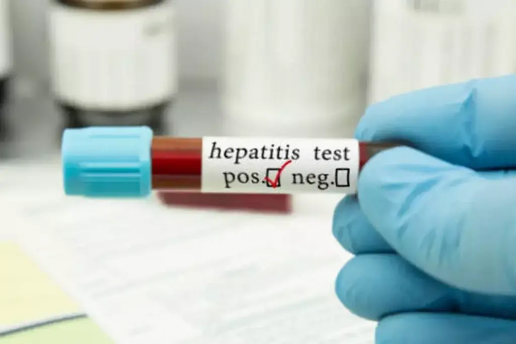 image 2492 LIV Hospital