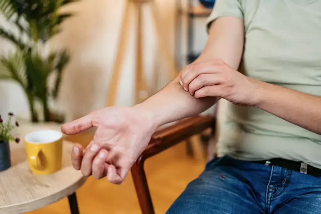 How to Heal Mosquito Bites Fast: 7 Relief Methods