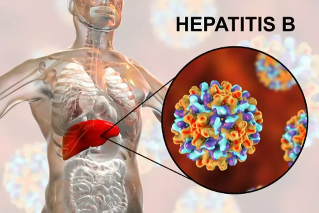 5 Stages of Hepatitis B Infection: Acute to Chronic 3 5 Stages of Hepatitis B Infection: Acute to Chronic