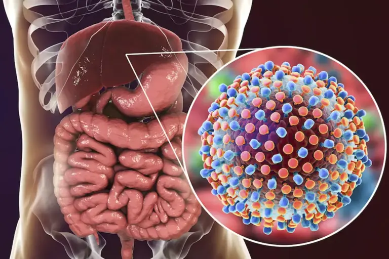 Can You Get Hepatitis A From Saliva or Kissing?