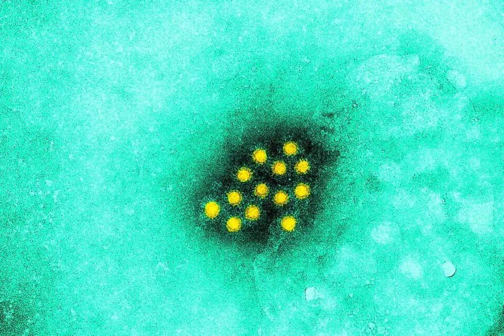 4 Phases of Hepatitis A: Symptoms and Stages 3 4 Phases of Hepatitis A: Symptoms and Stages