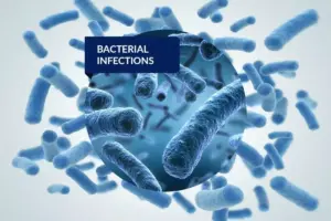 How Long Can a Viral or Bacterial Infection Last?
