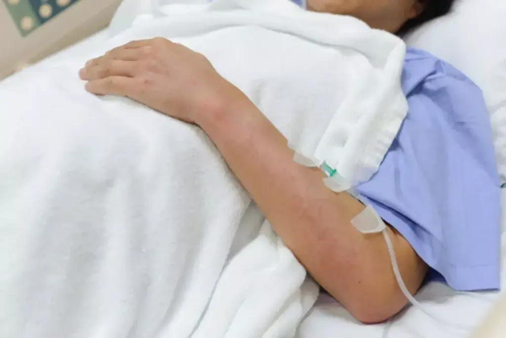 What's the Difference Between Malaria and Dengue Fever? 2 image 3349 LIV Hospital