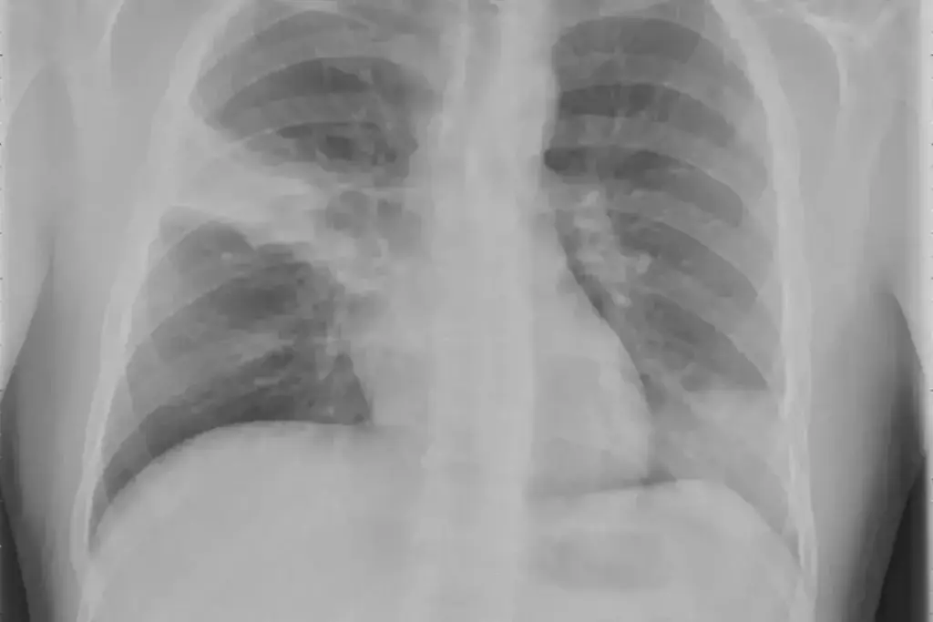 image 3365 LIV Hospital