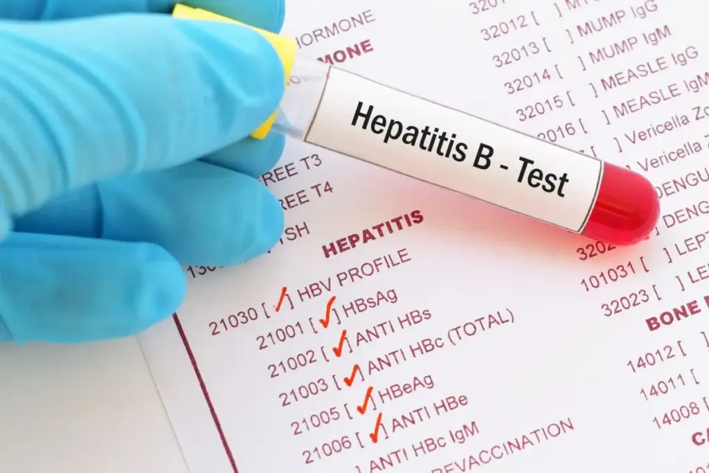 5 Essential Hepatitis B Serology Tests: Complete Screening Guide 1 5 Essential Hepatitis B Serology Tests: Complete Screening Guide
