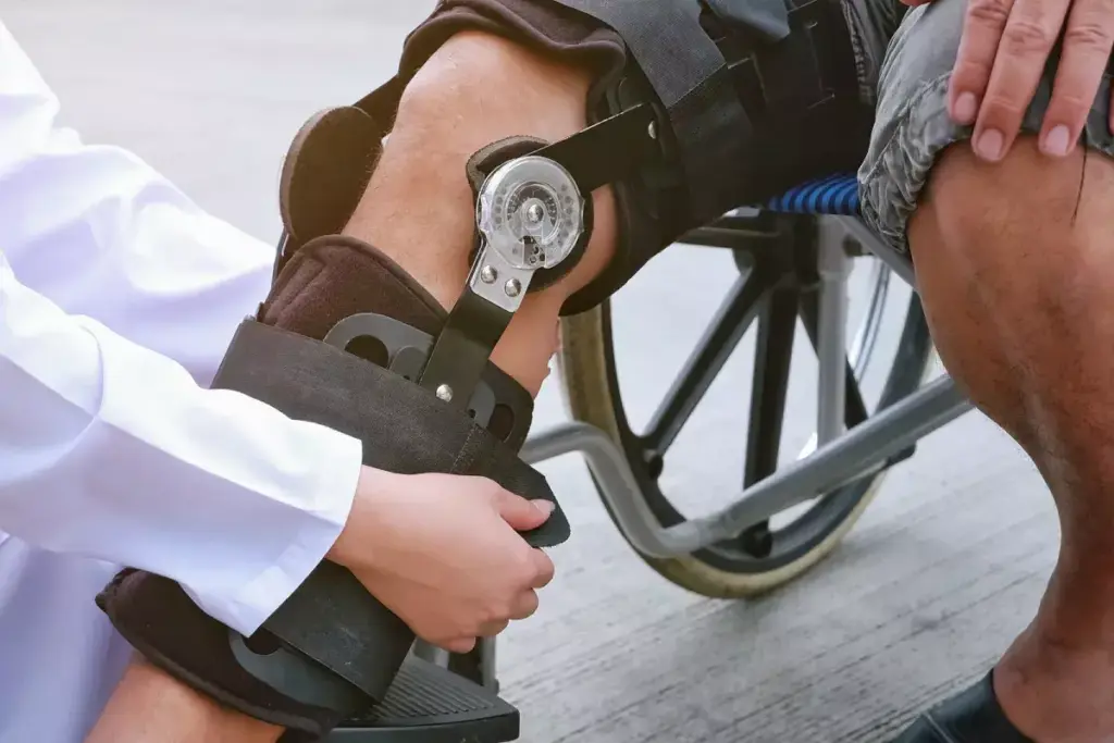 What Does a Torn ACL Look Like on an MRI?