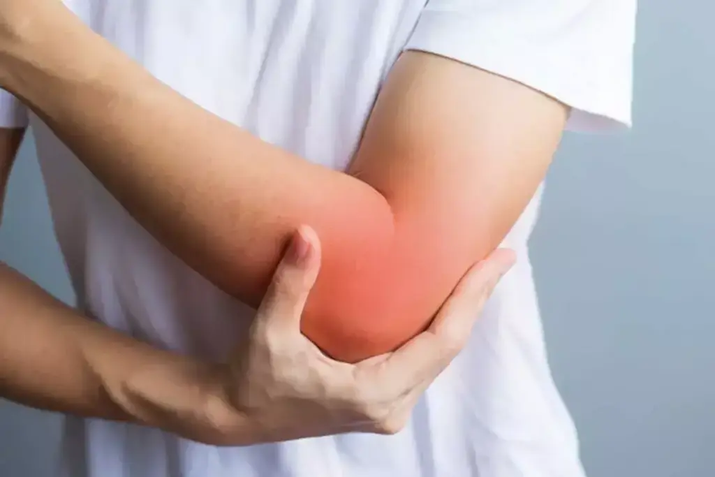 How to Treat Elbow Pain and Swelling: A Step-by-Step Guide