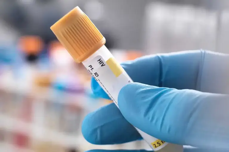 What’s the Difference Between HIV-1 and HIV-2?