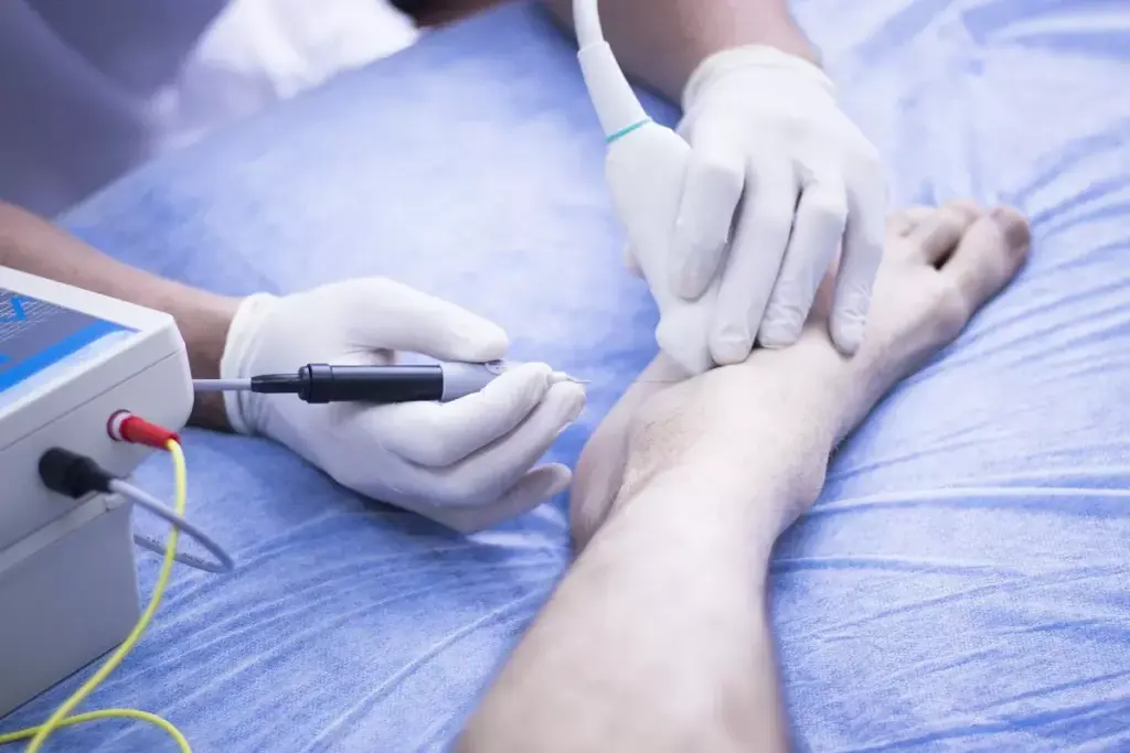 How to Perform a Hand Nerve Conduction Test