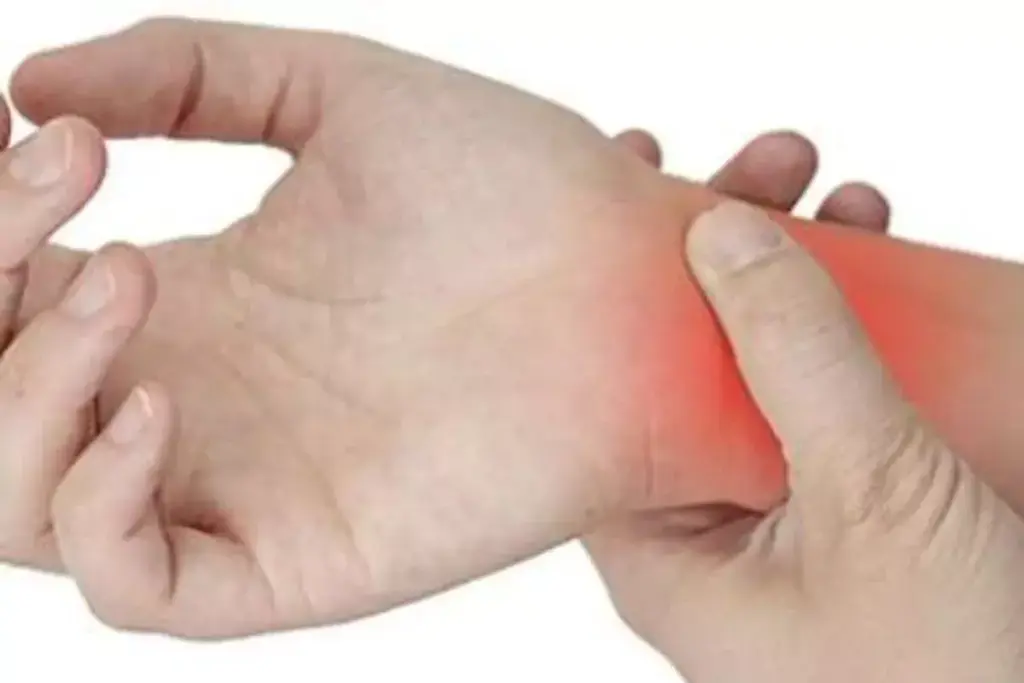 How to Drive After Carpal Tunnel Surgery: Timeline & Tips