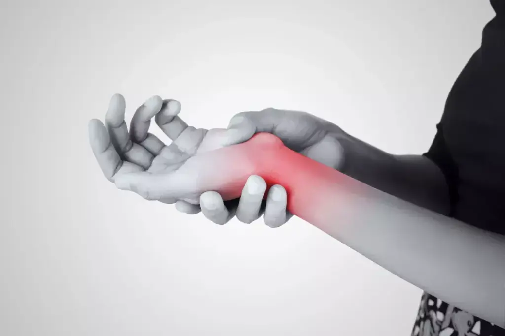 What Kind of Doctor Treats Carpal Tunnel Syndrome?