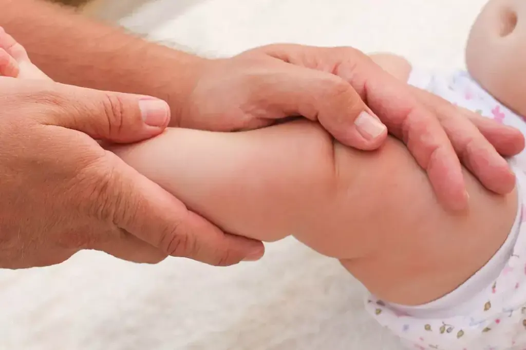 How to Manage Clubfoot: Treatment Options