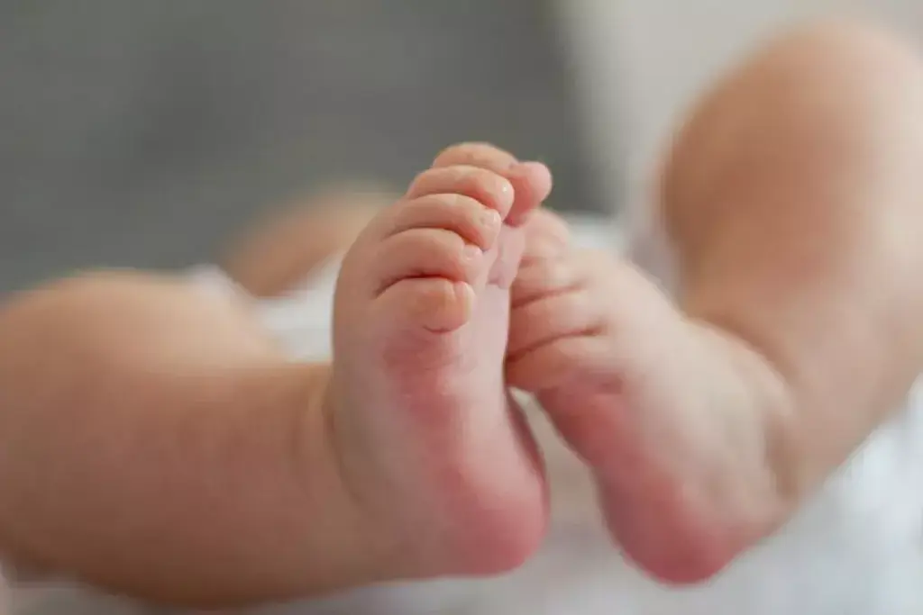 What Is Clubfoot and How Is It Treated in Babies?