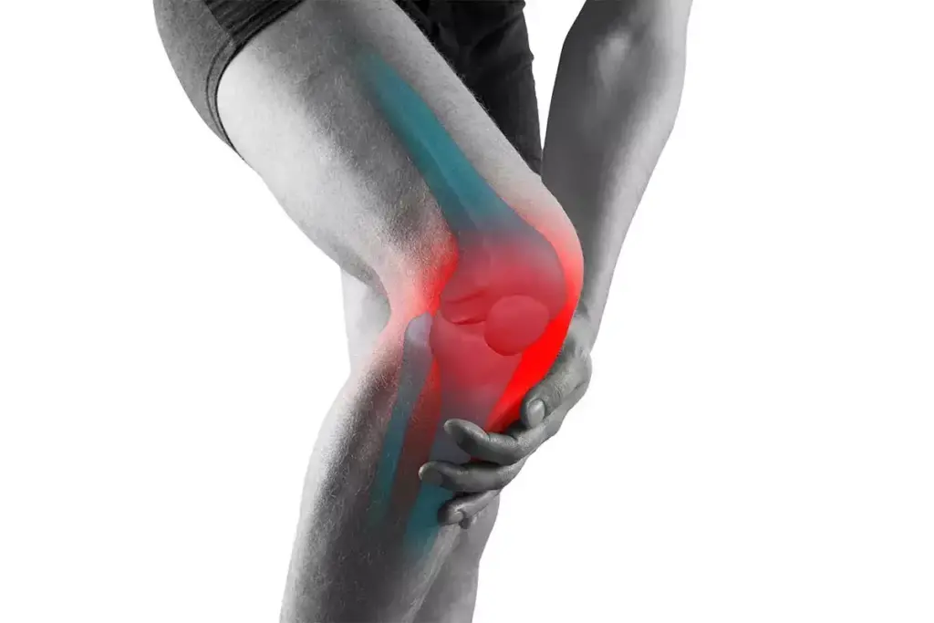 What Does MCL Knee Pain Feel Like? Complete Symptom Guide