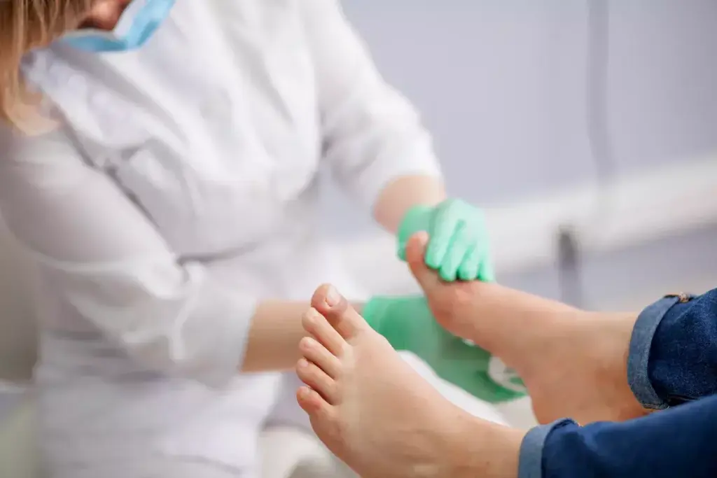 How to Use Ponseti Cast for Clubfoot Treatment