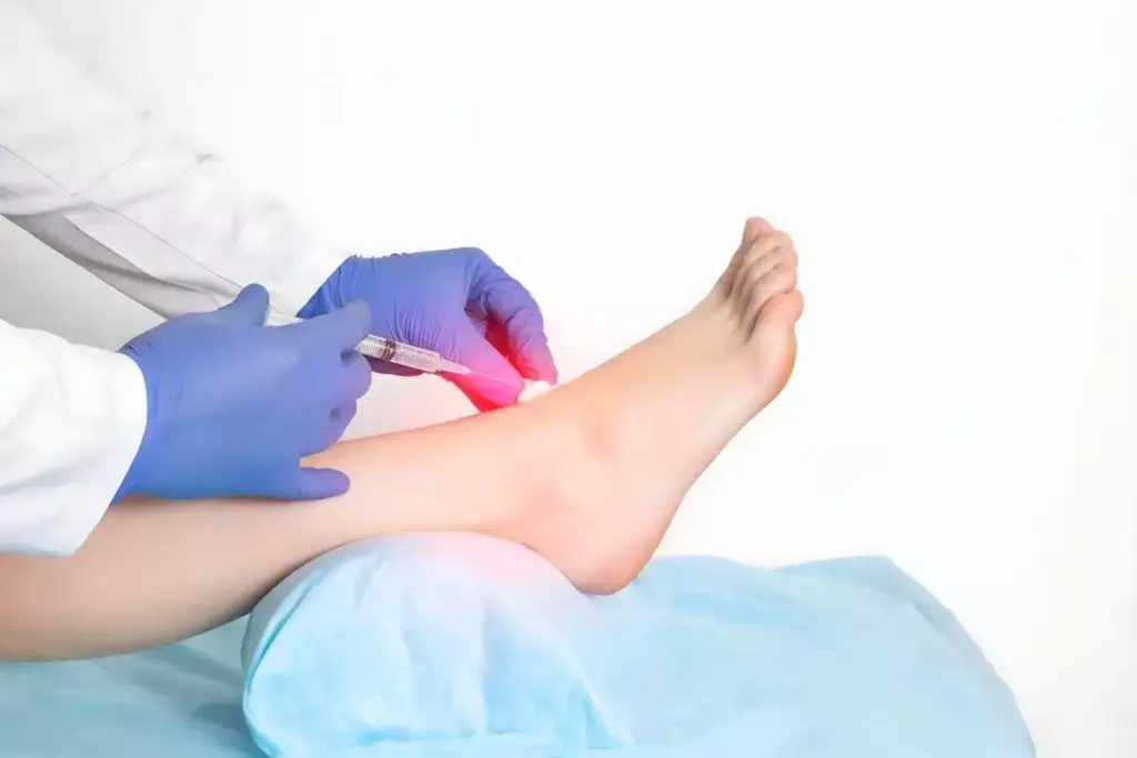 How to Heal Ligaments: Can They Grow Back?