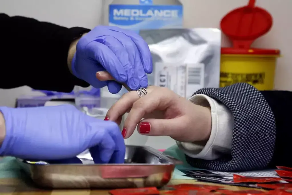 What Causes Swollen Lymph Nodes in HIV and AIDS?