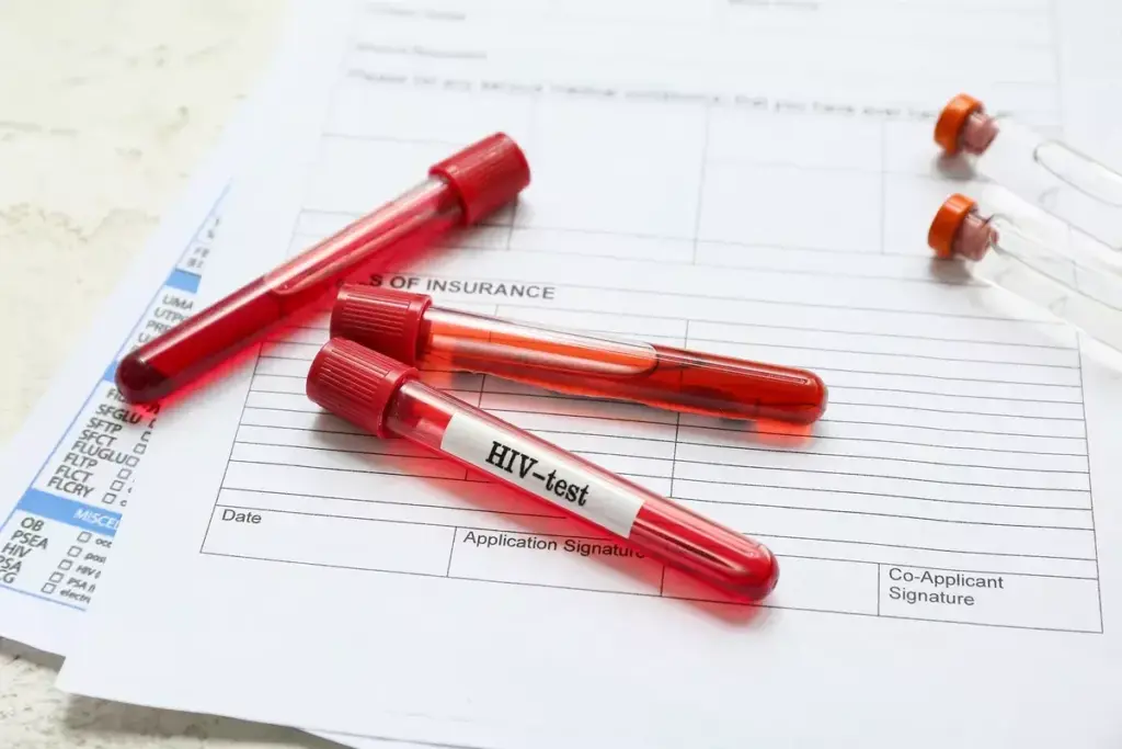 Can HIV Be Transmitted Through Saliva? What You Need to Know