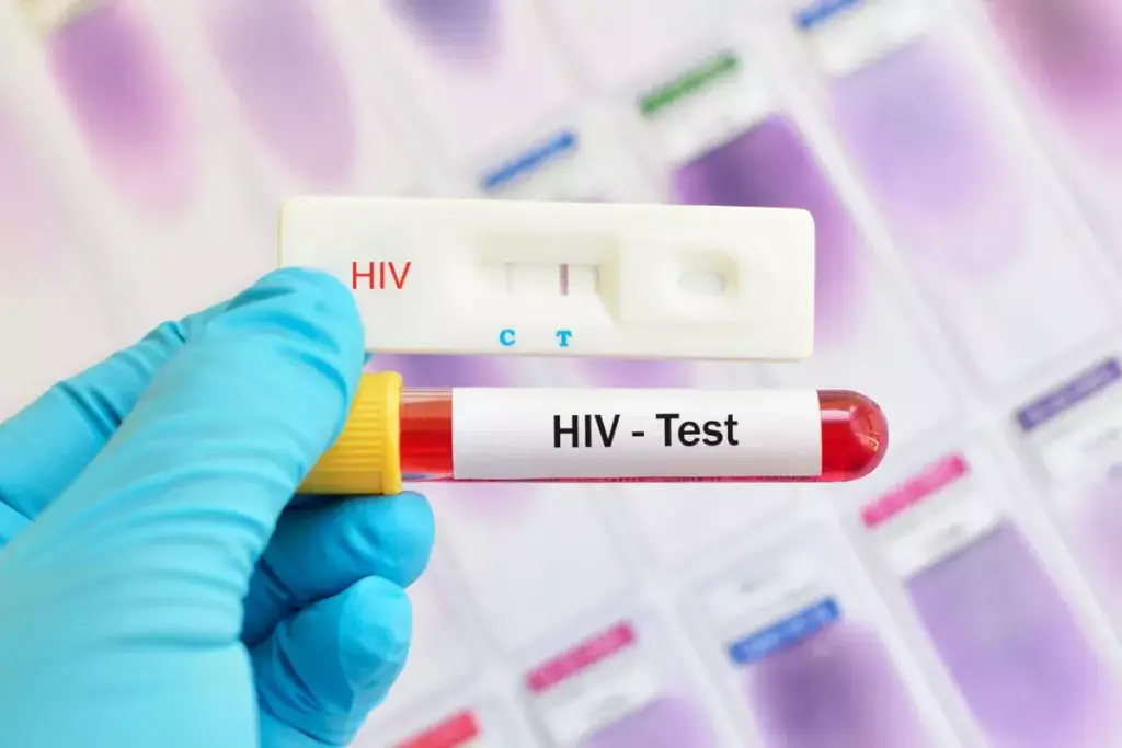 7 Early Signs of HIV in Men You Shouldn't Ignore: Understanding HIV Urine Symptoms and More