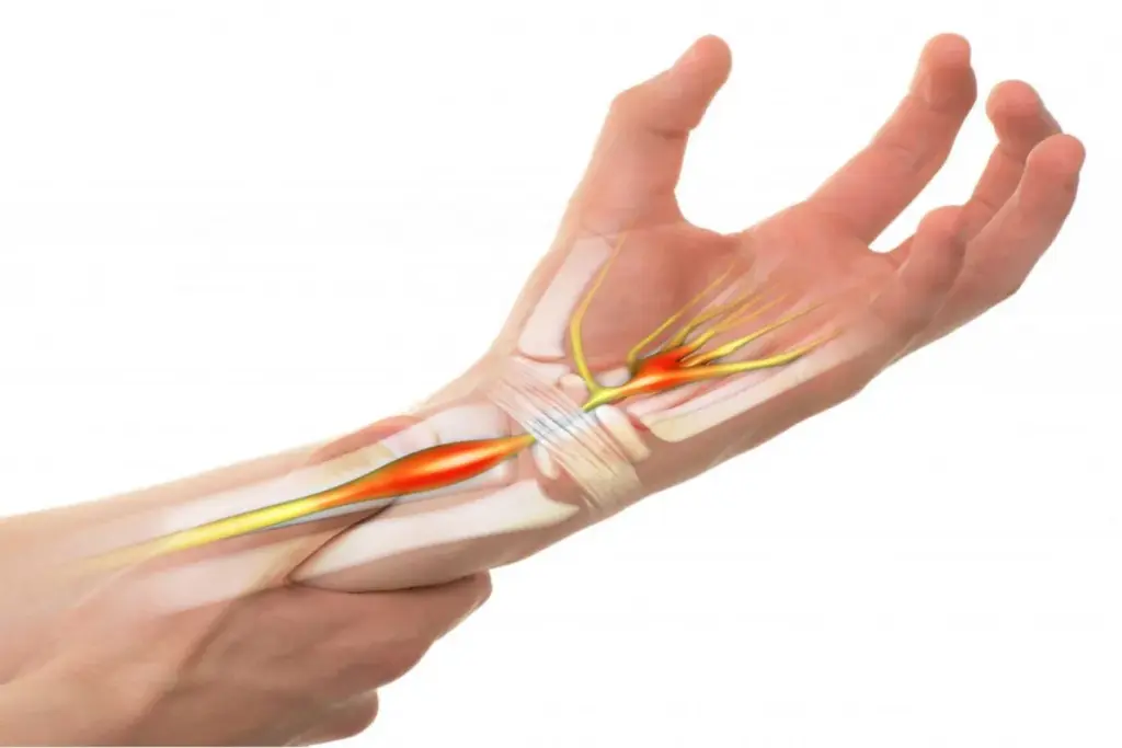 How to Perform a Hand Nerve Conduction Test