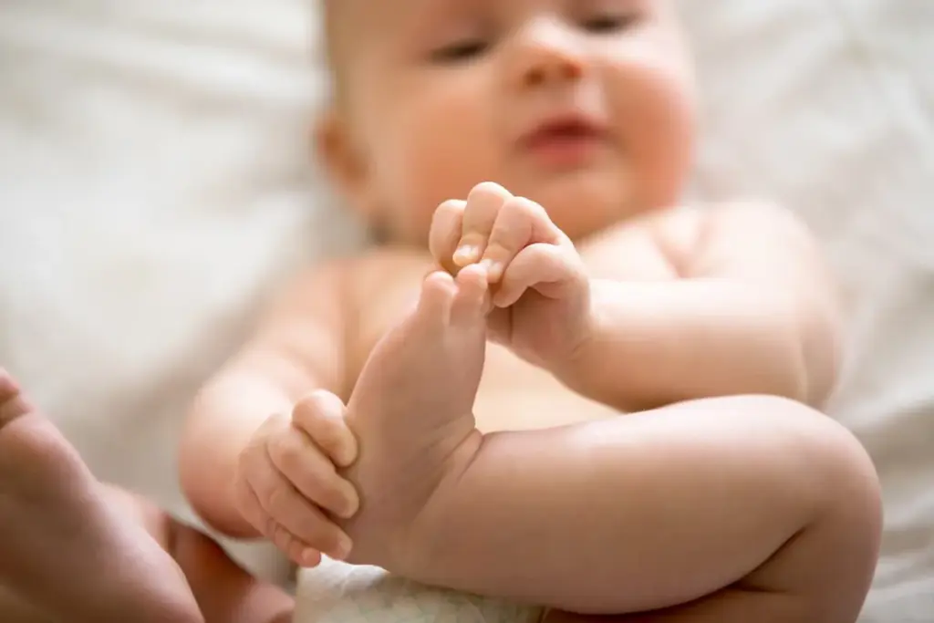 What Is Clubfoot and How Is It Treated in Babies?