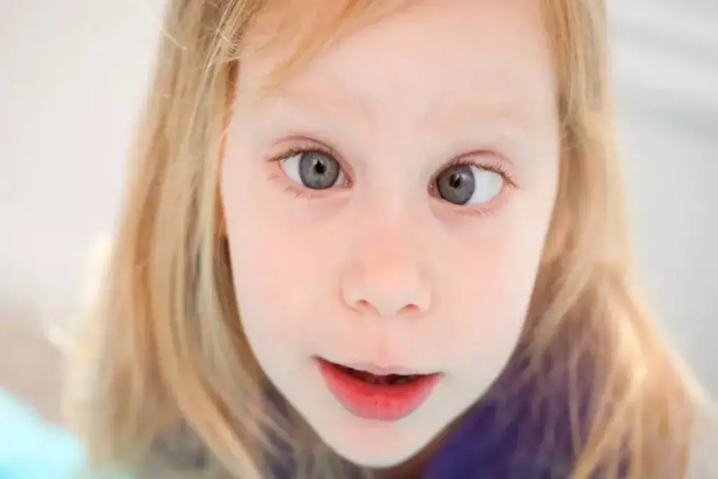 Understanding Intermittent Exotropia and Its Impact